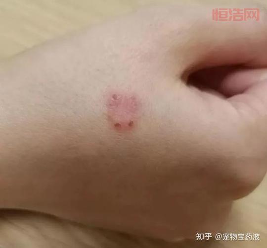 人得了猫癣不治疗会自己好吗？别侥幸，这有答案！