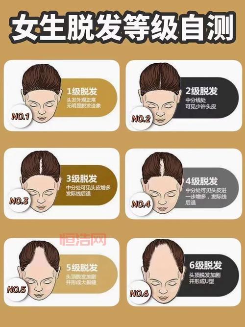 TOUFEI的原因与解决方法：脱发护理全指南
