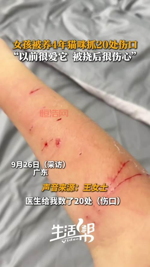 刀疤怎么抓捕？这些地方出刀疤几率很高！